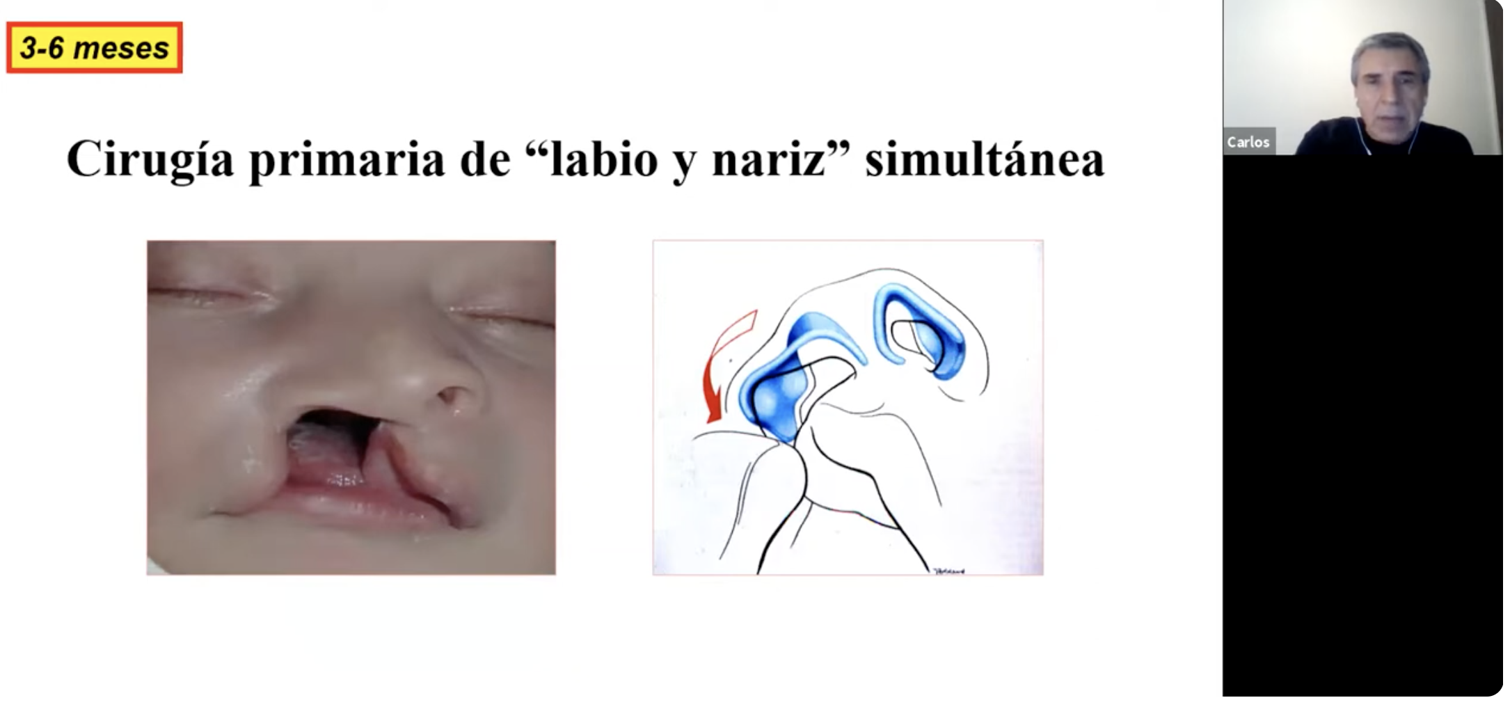 Curso online “Conversatorios Cirugía Pediatrica”